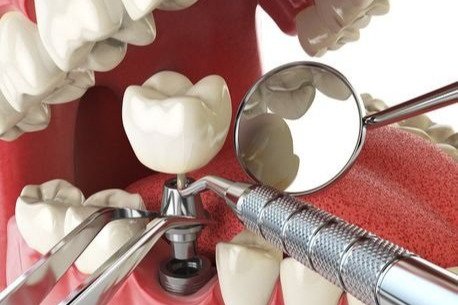 AdobeStock_123127657-900